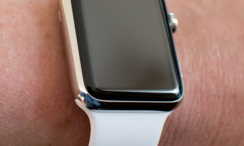 Apple Watch am Arm