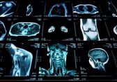 Nvidia über Augmented Reality für Radiologie